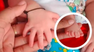 Bayi Perempuan Lahir dengan 6 Jari